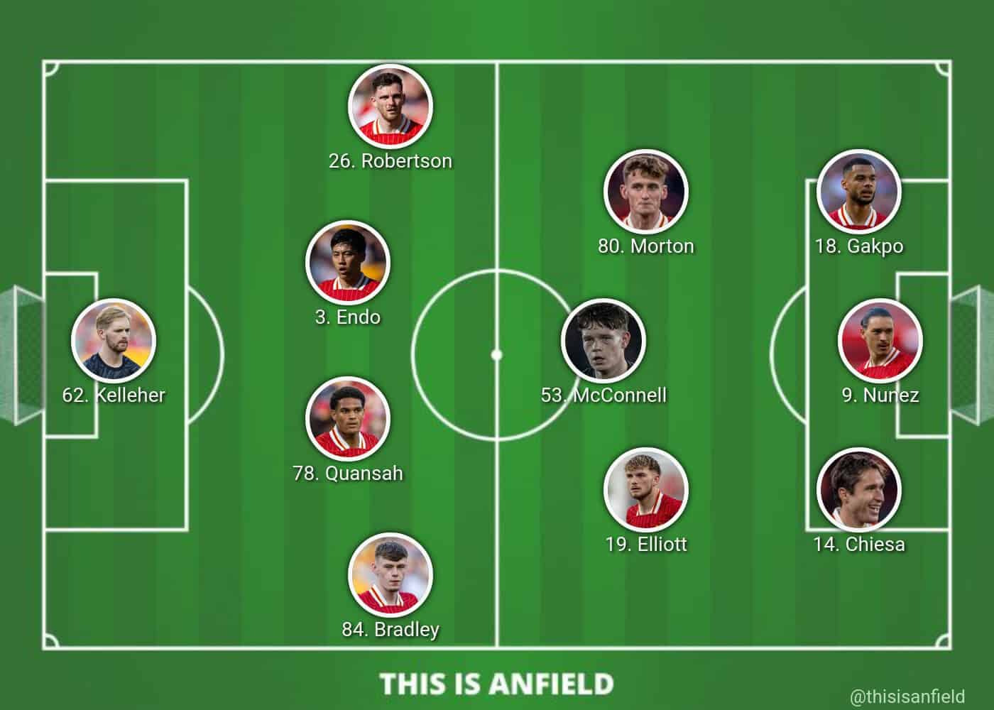 Liverpool lineup options vs. PSV 10 changes & 1 debut as rotation confirmed Liverpool FC