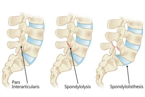 Conor Bradley injury (Dr Raj)