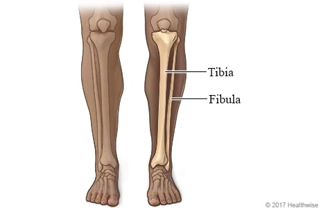 Explaining Curtis Jones’ injury and 'tibial stress reaction ...